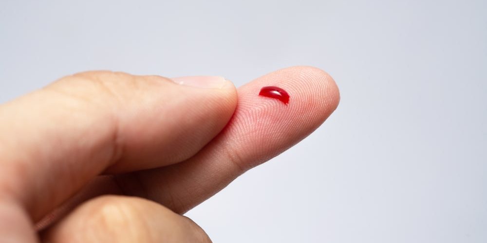 Determination-of-Bleeding-Time