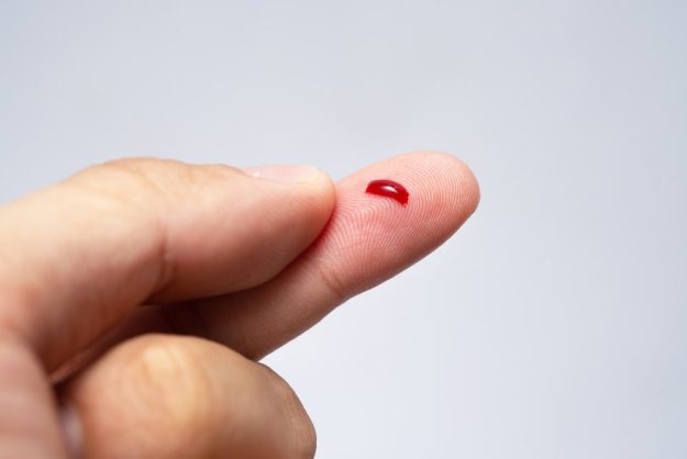 Determination-of-Bleeding-Time