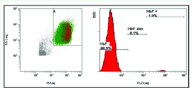 The-second-examination-of-FMH-1-week-after-the-delivery-cytometric-analysis-of-sample