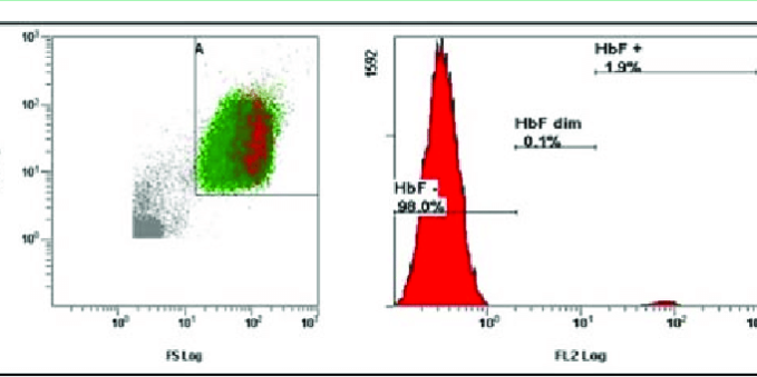 The-second-examination-of-FMH-1-week-after-the-delivery-cytometric-analysis-of-sample