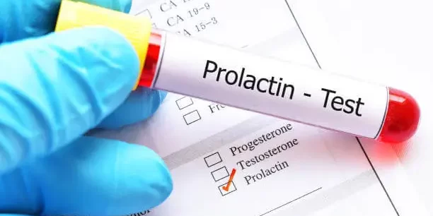 Serum-Prolactin-Test-1