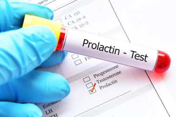 Serum-Prolactin-Test-1