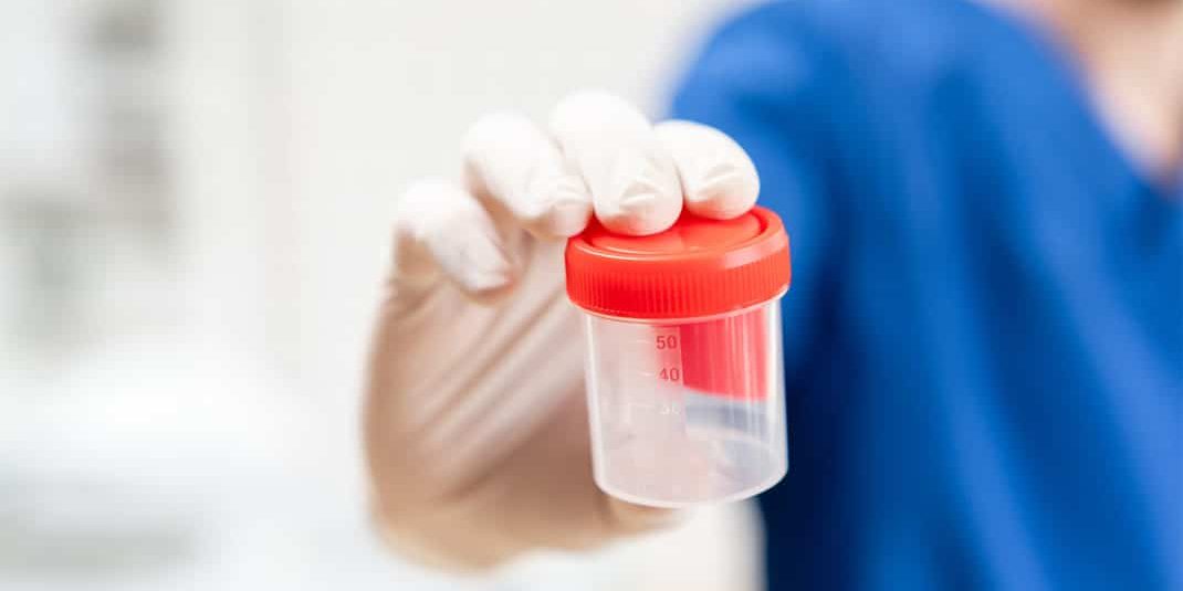doctor in blue uniform and latex gloves is holding an empty plastic container for taking urine samples, light background. Medical concept.
