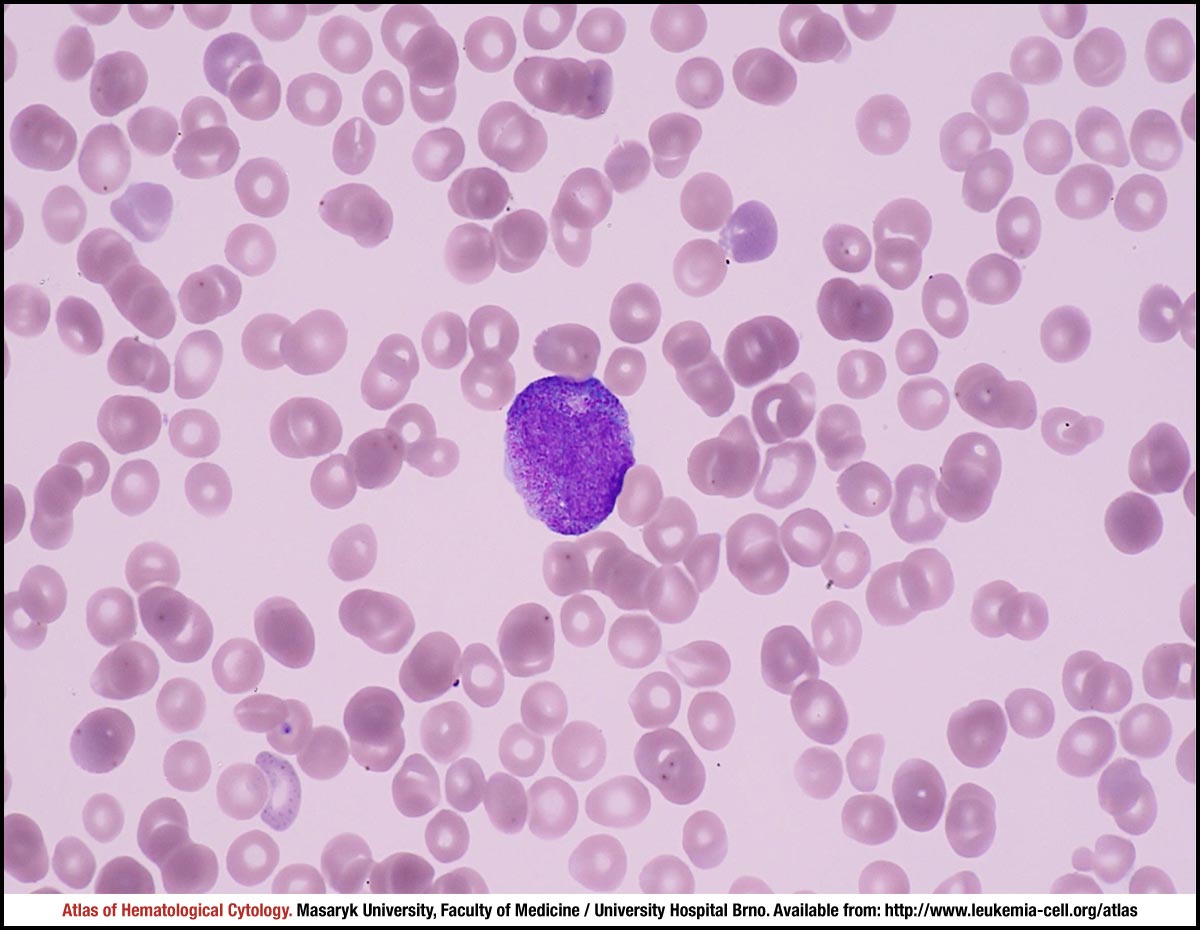 آزمایشگاه چکاپ