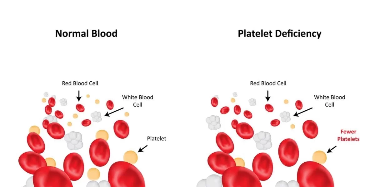 ImageForArticle_22459_16516995120156132