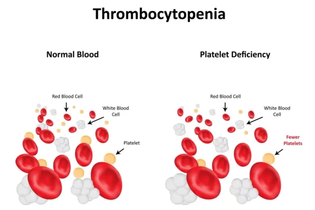 ImageForArticle_22459_16516995120156132