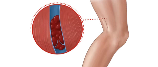 Leg3-800-e1676577353288