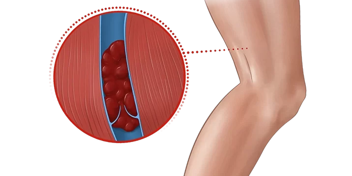 Leg3-800-e1676577353288