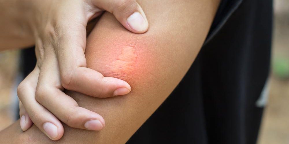 60bdb3dd31073021ab7b961f_AdobeStock_230200995