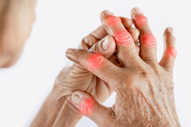 Rheumatoid-Arthritis
