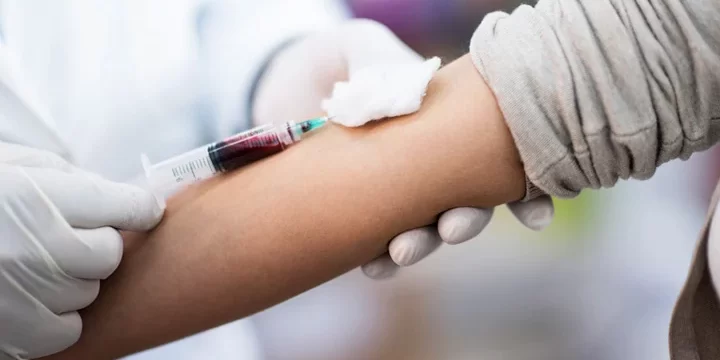 22021-calcium-blood-test