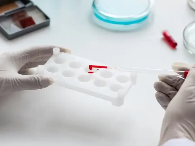 Bombay-blood-group-genetics