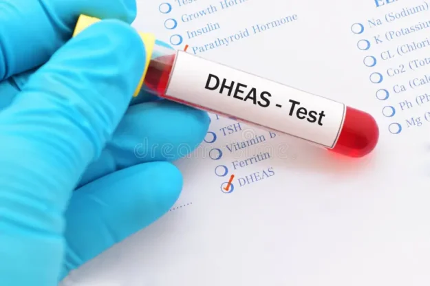 dheas-test-blood-sample-hormone-103015207
