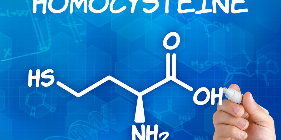 Hand with pen drawing the chemical formula of homocysteine