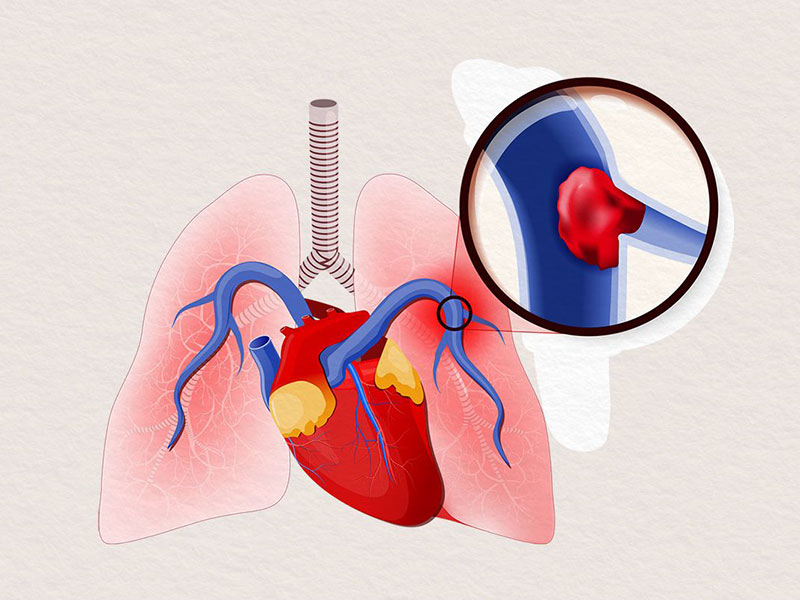 آزمایشگاه چکاپ 11 آزمایشگاه چکاپ