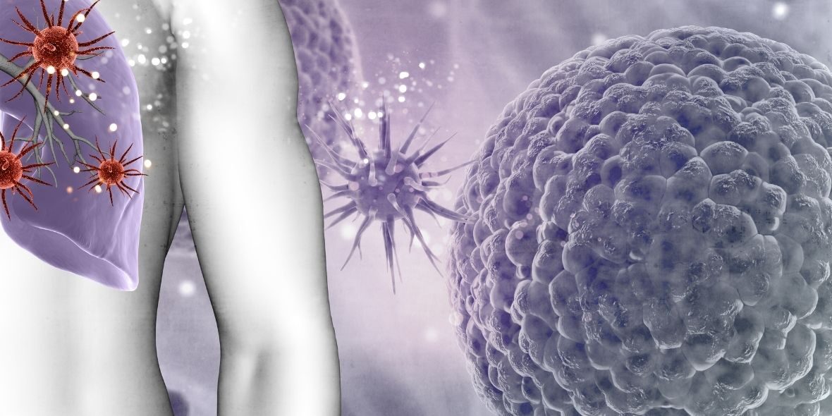 chronic-disease-anemia